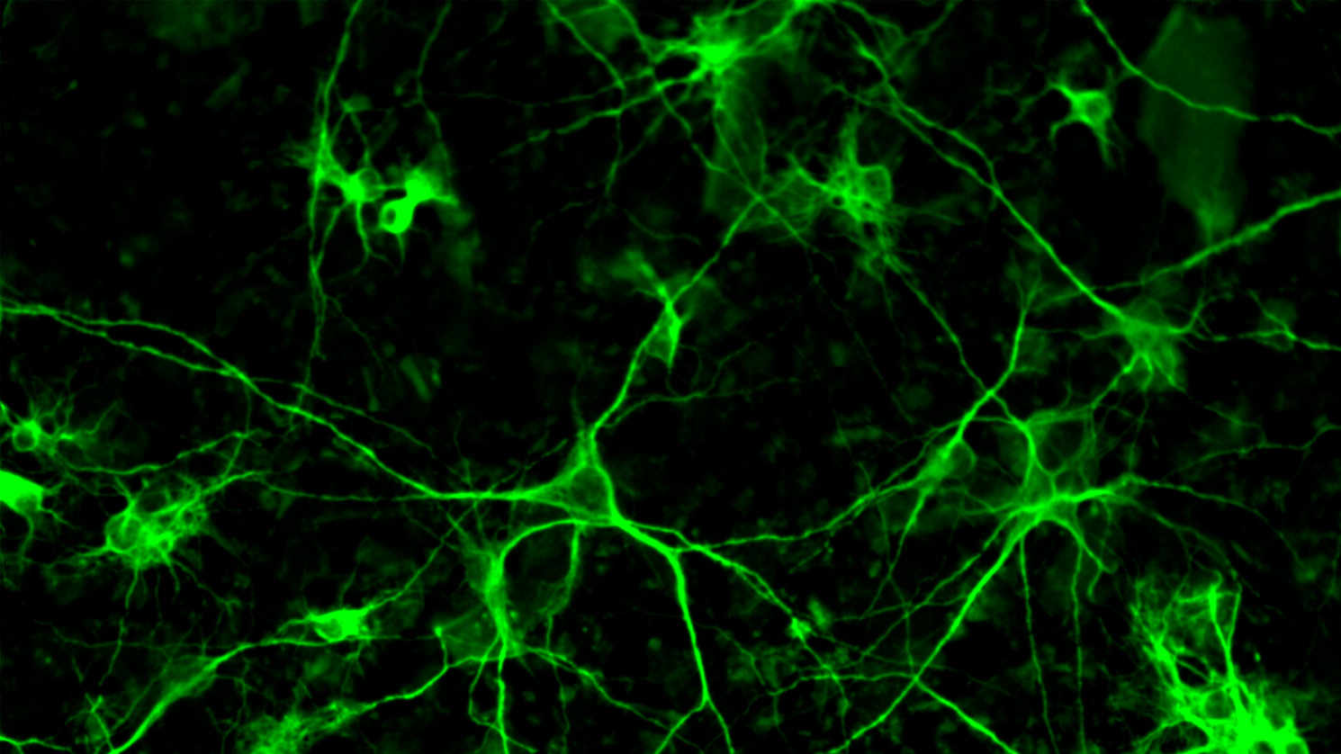 Imagerie médicale de neurones